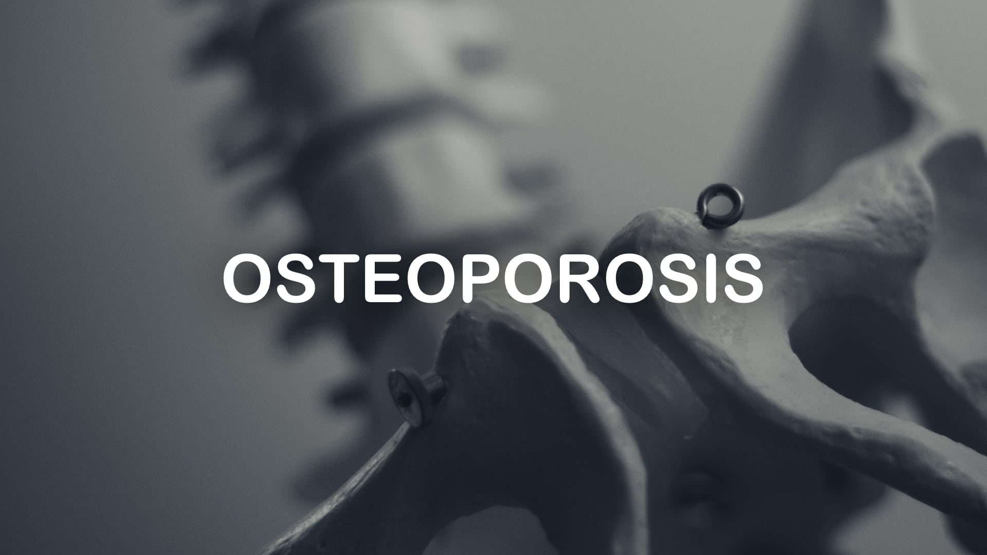 class_Osteoporosis